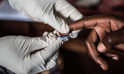 TUYÊN BỐ TỪ CHỐI TRÁCH NHIỆM: Châu lục nào có số người nhiễm HIV cao nhất?