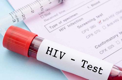 Xét nghiệm HIV sau 6 tháng có chính xác không? Lý do tại sao?